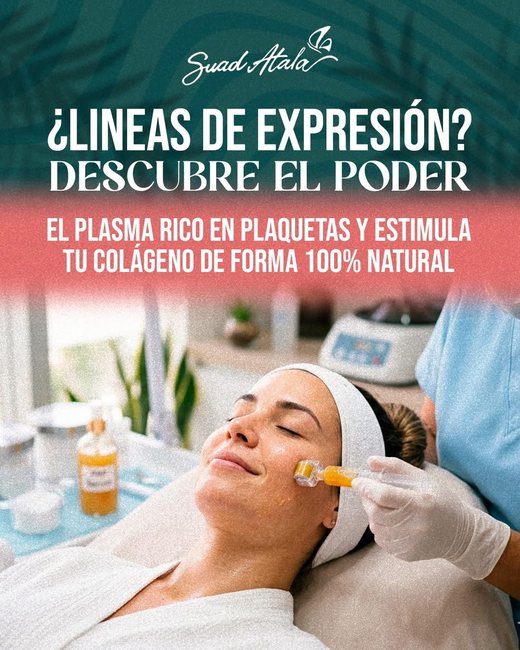 Plasma rico en plaquetas